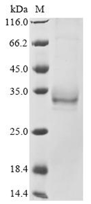 Recombinant Mouse Erythropoietin receptor (Epor), partial (CSB-MP007744MO1)