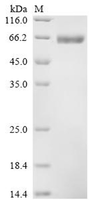 Recombinant Human Hyaluronidase PH-20 (SPAM1), partial (CSB-MP022471HU1)