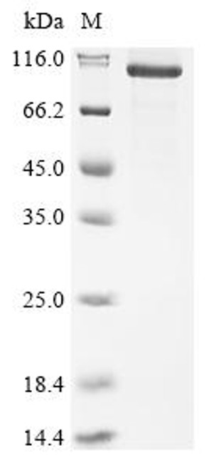 Recombinant Mouse Cartilage acidic protein 1 (Crtac1), partial (CSB-MP005997MO1)
