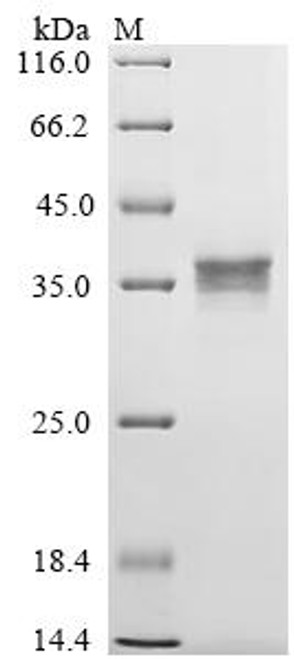 Recombinant Human Urocortin-2 (UCN2), partial (CSB-MP822298HU)