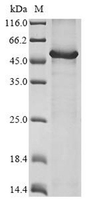 Recombinant Human Hyaluronidase PH-20 (SPAM1) (CSB-MP022471HU)