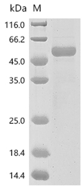 Recombinant Human Somatotropin (GH1) (CSB-MP009407HUh8)