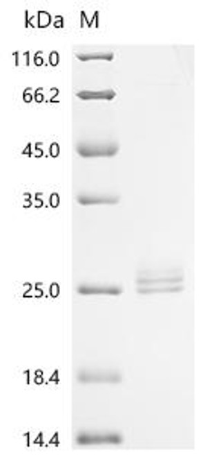 Recombinant Rat Interleukin-11 (Il11) (CSB-MP859561RAb0)