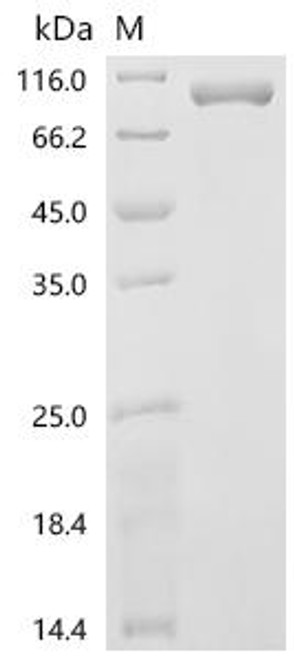 Recombinant Rat Peptidylglycine alpha-amidating monooxygenase (Pam), partial (CSB-MP017417RAn1)