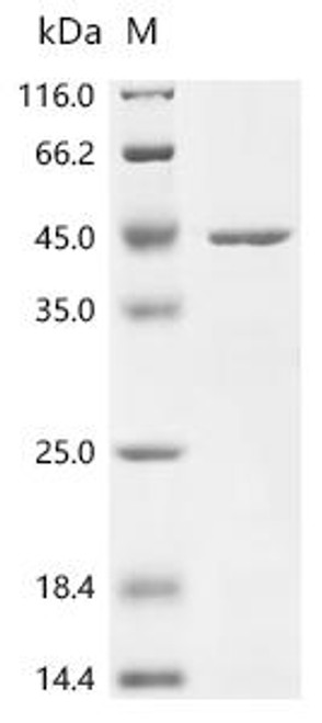 Recombinant Bacillus subtilis Penicillin-binding protein 3 (pbpC), partial (CSB-EP331705BRJ1)