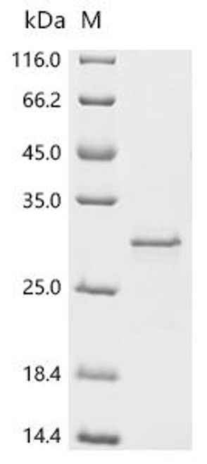Recombinant Escherichia coli O157:H7 Uncharacterized protein yqgB (yqgB) (CSB-EP353135EOD)