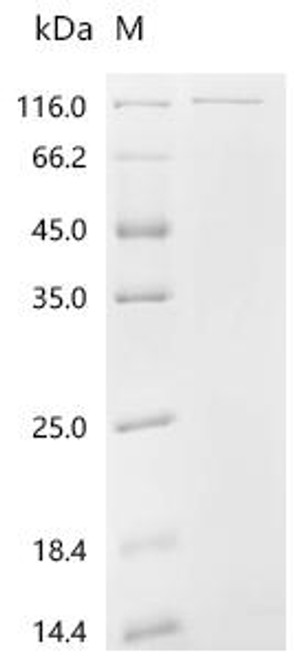 Recombinant Human Proliferation marker protein Ki-67 (MKI67), partial (CSB-EP014597HU1)
