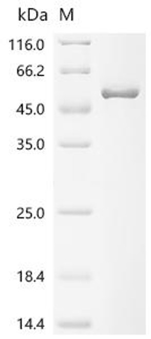 Recombinant Human Cartilage-associated protein (CRTAP) (CSB-EP005999HU)