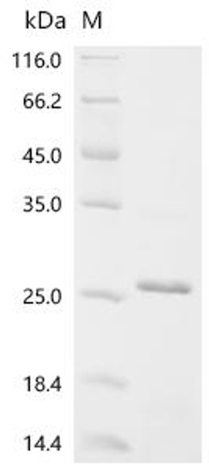 Recombinant Human Astrotactin-1 (ASTN1), partial (CSB-EP002251HU)
