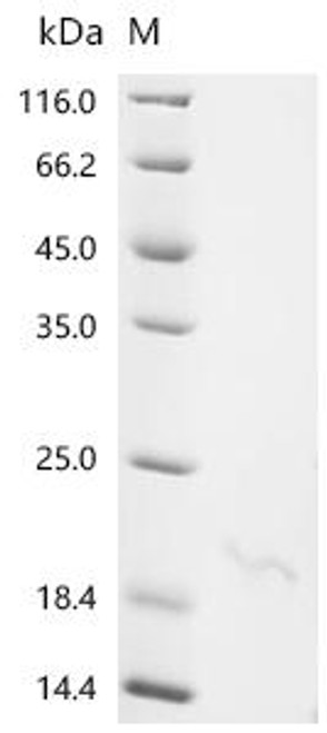 Recombinant Mouse Alpha-defensin 24 (Defa24) (CSB-EP685929MO)