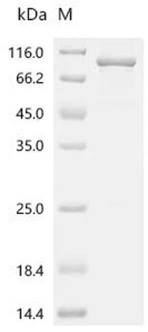 Recombinant Human Prolyl 3-hydroxylase 1 (P3H1) (CSB-EP657676HU)