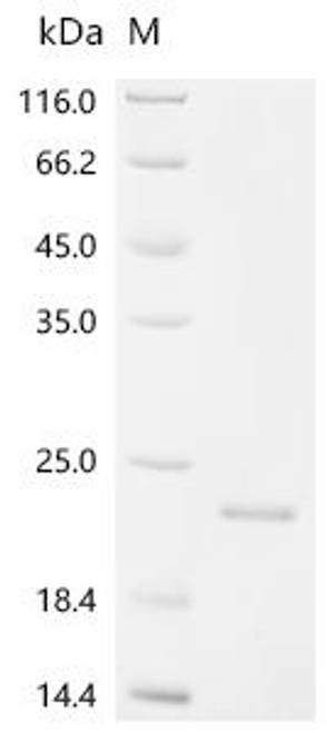 Recombinant Bovine Osteocalcin (BGLAP) (CSB-EP002682BO)
