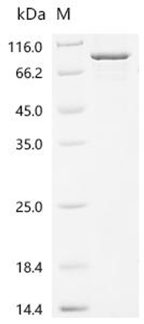 Recombinant Human Heterogeneous nuclear ribonucleoprotein K (HNRNPK), partial (CSB-EP010611HUc0)