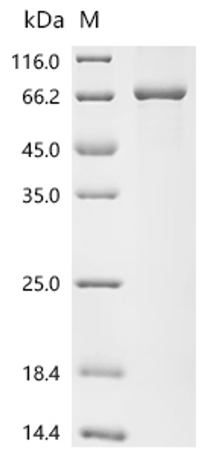 Recombinant Human Acetylcholinesterase (ACHE) (CSB-EP001154HU)