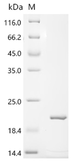 Recombinant Macaca fascicularis Parathyroid hormone (PTH) (CSB-EP018987MOVc7)