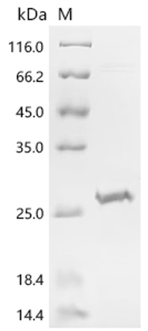 Recombinant Human Enamelin (ENAM), partial (CSB-EP007662HUc7)