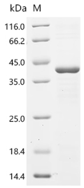 Recombinant Human Cysteine-rich protein 1 (CRIP1), partial (CSB-EP005969HUf0)