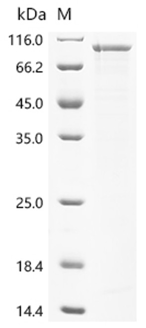 Recombinant Klebsiella pneumoniae subsp. pneumoniae Penicillin-binding protein 1B, partial (CSB-EP6059GNAg5)