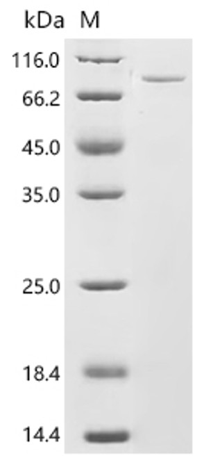Recombinant Human Peroxisomal multifunctional enzyme type 2 (HSD17B4) (CSB-EP010774HU)