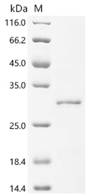 Recombinant Bunodosoma granuliferum Delta-actitoxin-Bgr2a (CSB-EP314923BNL)