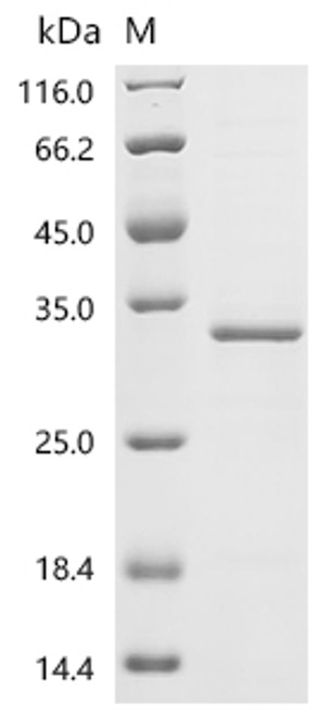 Recombinant Arabidopsis thaliana TATA-box-binding protein 1 (TBP1) (CSB-EP329782DOAa0)
