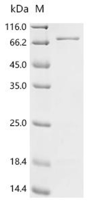 Recombinant Escherichia coli Cytoplasmic trehalase (treF) (CSB-EP6077ENR)