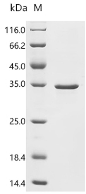 Recombinant Human Transcriptional enhancer factor TEF-3 (TEAD4), Partial (CSB-EP618010HU1g5)