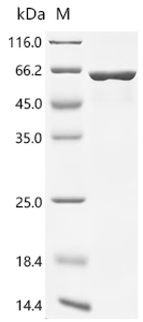 Recombinant Human Vimentin (VIM) (CSB-EP025857HUc7)