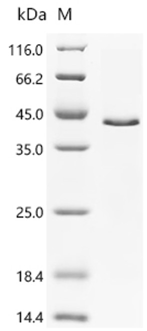 Recombinant Human Protein Wnt-3a (WNT3A), partial (CSB-EP026136HU1c7)