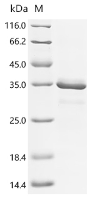 Recombinant Streptococcus sp. group G Immunoglobulin G-binding protein G (spg), partial (CSB-EP322577SNDb0(F10))
