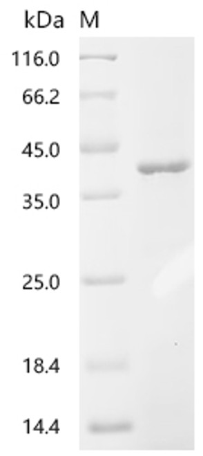 Recombinant Influenza B virus Nucleoprotein (NP), partial (CSB-EP319610IIRc7)