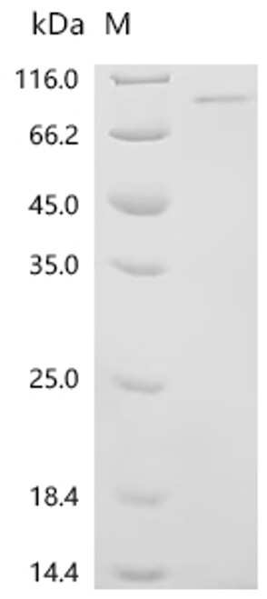 Recombinant Mouse Receptor-interacting serine/threonine-protein kinase 1 (Ripk1) (CSB-EP720181MOc7)