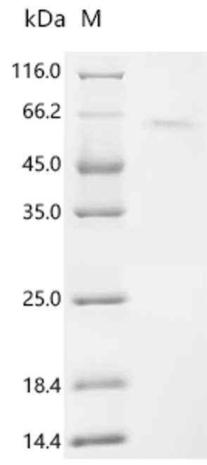 Recombinant Human Kinesin-like protein KIF20B (KIF20B), partial (CSB-EP839399HU)