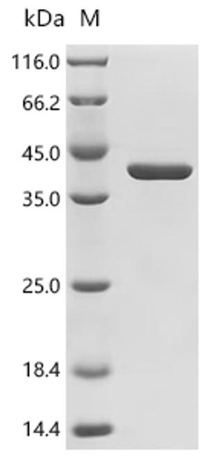 Recombinant Staphylococcus aureus Gamma-hemolysin component A (hlgA) (CSB-EP362888SKY)