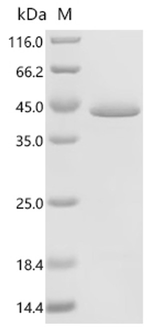 Recombinant Human L-lactate dehydrogenase B chain (LDHB) (CSB-EP012841HUc7)