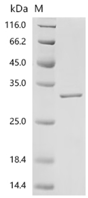 Recombinant Mouse Fibroblast growth factor 15 (Fgf15) (CSB-EP522052MOc7)