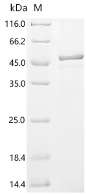 Recombinant Human Syncytin-1 (ERVW-1), partial (CSB-EP891578HUc7)