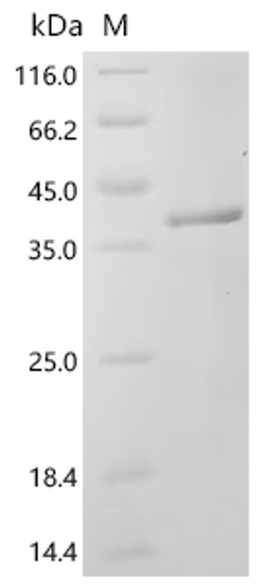 Recombinant Human Granzyme K (GZMK) (CSB-EP010084HU1d7)