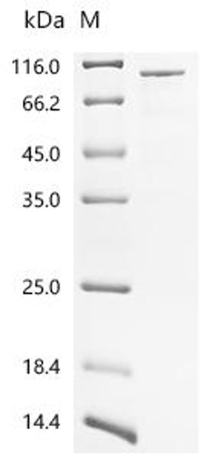 Recombinant Human E3 ubiquitin-protein ligase COP1 (COP1) (CSB-EP822821HU)