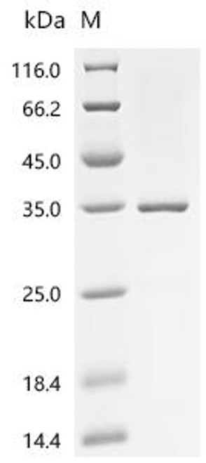Recombinant Human Retinoblastoma-associated protein (RB1), partial (CSB-EP019386HU)