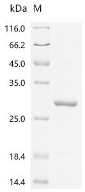 Recombinant Human Leucine-rich PPR motif-containing protein, mitochondrial (LRPPRC), partial (CSB-EP013105HU1)