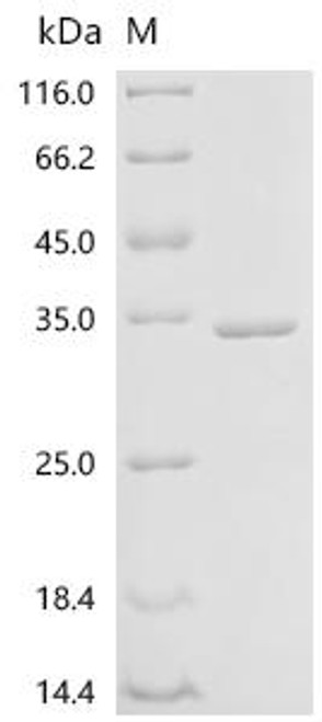 Recombinant Coxiella burnetii Chaperonin GroEL (groEL), partial (CSB-EP323108DXPc7)
