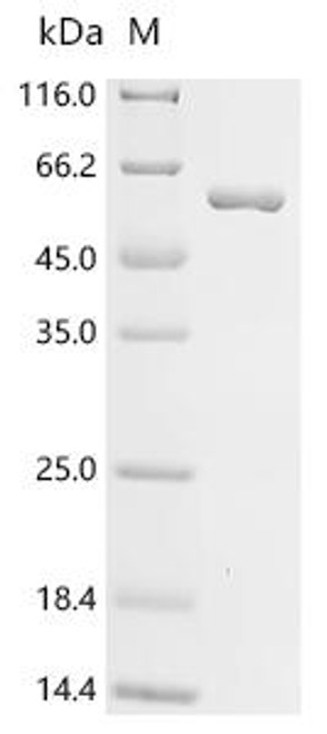 Recombinant Vaccinia virus Envelope protein H3 (OPG108) (X27S,X28S,X29S), partial, Biotinylated (CSB-EP329027VAD-B)