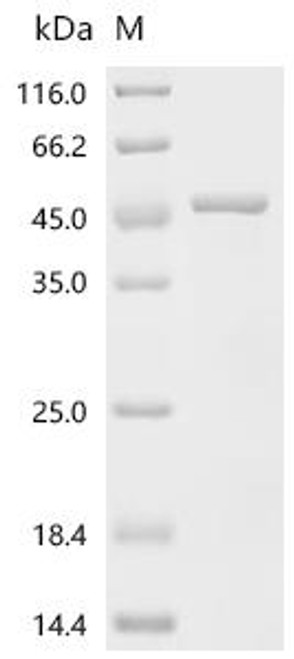 Recombinant Rat Dihydroorotate dehydrogenase (quinone), mitochondrial (Dhodh), partial (CSB-EP714357RA1c2)