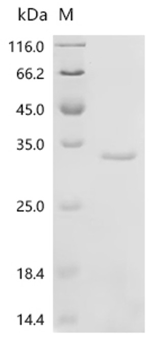 Recombinant Mouse Apoptosis-associated speck-like protein containing a CARD (Pycard) (CSB-EP861664MOd7)