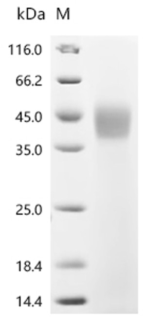 Recombinant Macrovipera lebetina Chymotrypsin-like protease VLCTLP (CSB-MP522192MPJd7)