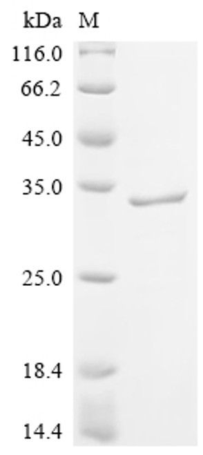 Recombinant Human Pulmonary surfactant-associated protein A1 (SFTPA1) (CSB-MP810281HU)