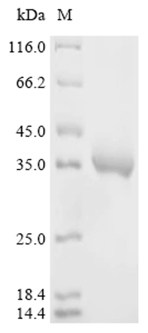 Recombinant Dendroaspis angusticeps Natriuretic peptide DNP (CSB-MP329805DBG)