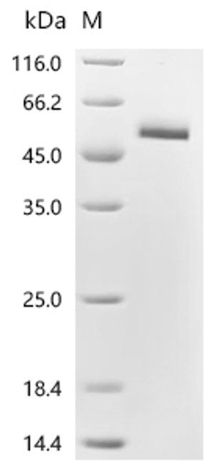 Recombinant Human R-spondin-2 (RSPO2), partial (CSB-MP751021HU1(M))