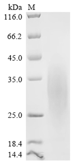 Recombinant Rat Glucagon-like peptide 1 receptor (Glp1r), partial (Active) (CSB-MP009514RA2)